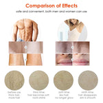 Laser Hair Removal for Women & Men, Permanent IPL Hair Removal System Results on Face and Body - Safe And Effective