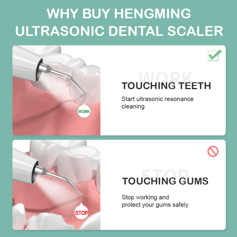 Ultrasonic Tooth Plaque Remover with HD WiFi Camera LED Lights Electric Tooth Cleaner Portable Tartar Remover